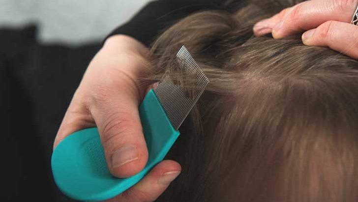 A Review of Lice Treatment Systems That Use Insecticide-Based Solutions to Eliminate Lice